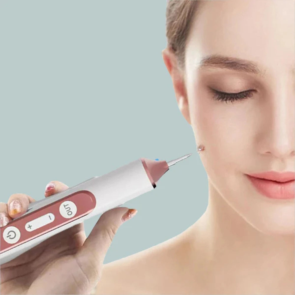 Plasma Pen for Skin Tag Wart Mole Removal